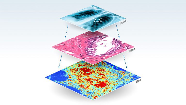 PI And Preora Healthcare Partner To Bring Novel Detection Technology To