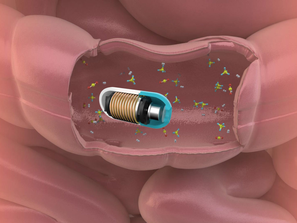 Atmo Gas Capsule in the gut