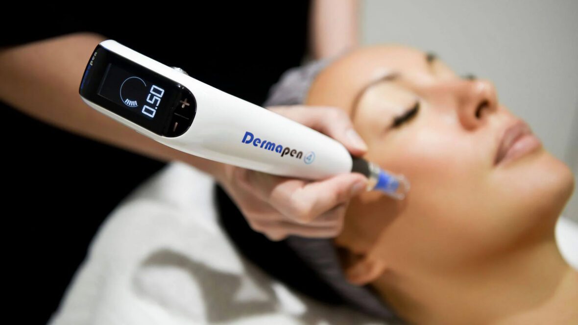 Dermapen Microneedling